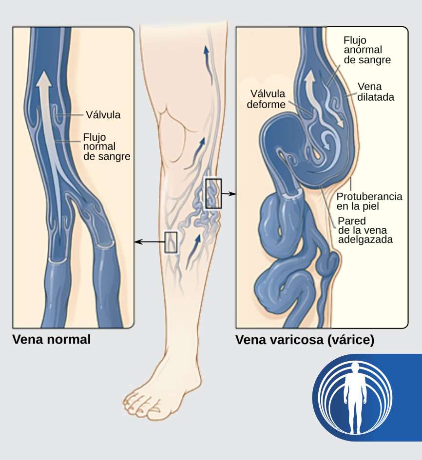 cirugia vascular