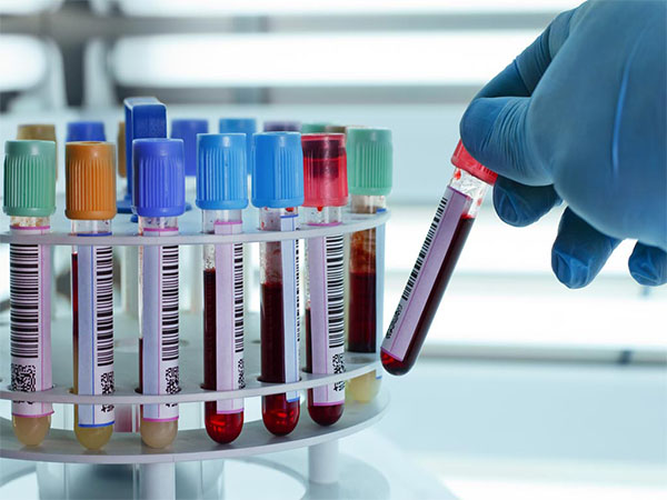 Laboratorio clinico